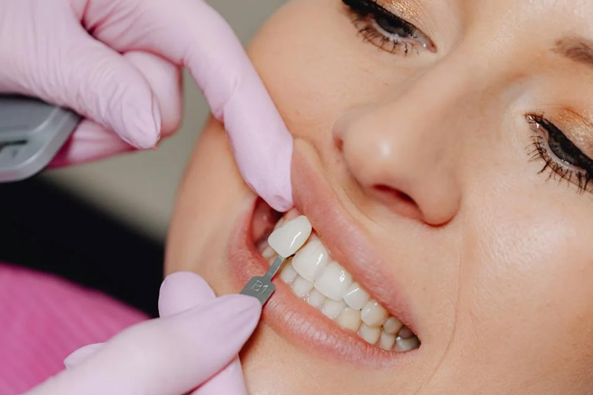 Dental Implant in Vasundhara, Ghaziabad