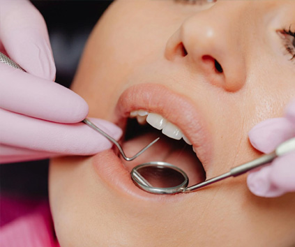 Dental Implant in Vasundhara, Ghaziabad