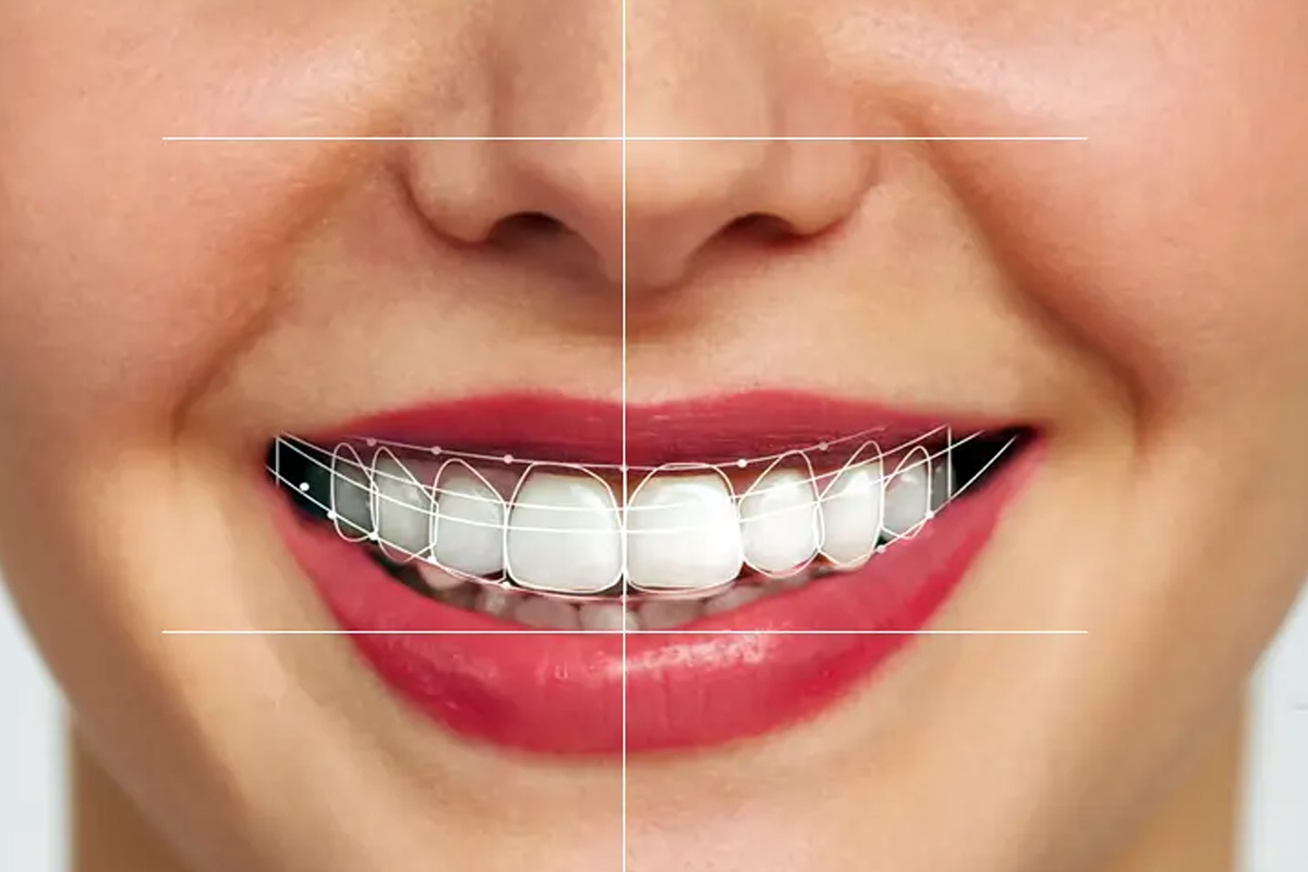 Dental Implant in Vasundhara, Ghaziabad