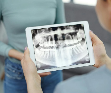 Dental Implant in Vasundhara, Ghaziabad