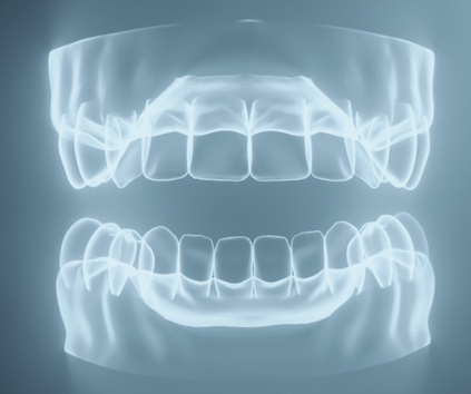 Dental Implant in Vasundhara, Ghaziabad