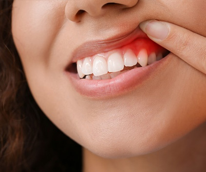 Dental Implant in Vasundhara, Ghaziabad