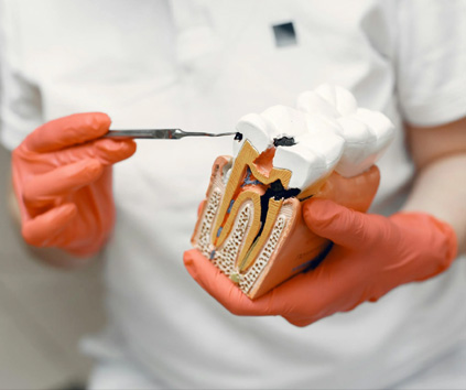Dental Implant in Vasundhara, Ghaziabad