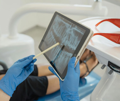 Dental Implant in Vasundhara, Ghaziabad