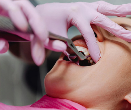 Dental Implant in Vasundhara, Ghaziabad