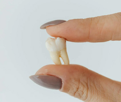 Dental Implant in Vasundhara, Ghaziabad