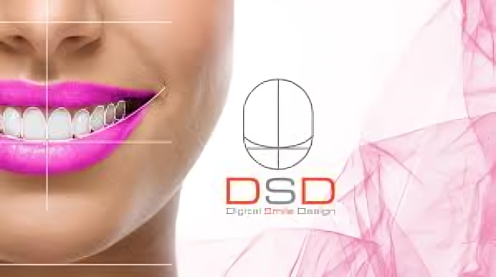 Digital Smile Design