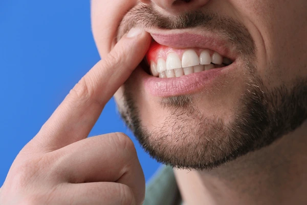 Gum Treatment: How To Improve Your Smile And Your Health