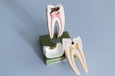 Root Canal Treatment: The Ultimate Guide to a Pain-Free Smile